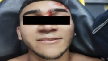 Hieren a 'El Dhiter', presunto extorsionador de la Unión Tepito, y cae detenido