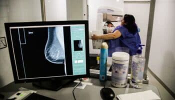 Inteligencia Artificial aumenta un 20% detección de cáncer de mama: estudio