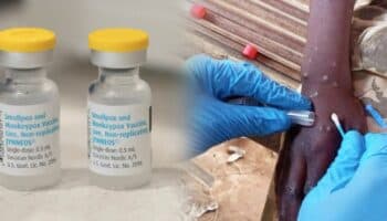 Viruela del mono | Cofepris autoriza la vacuna Jynneos contra mpox