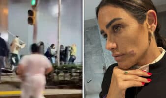 Rojo de la Vega denuncia agresión durante operativo en Zona Rosa; SSC asegura que fue riña con comerciantes